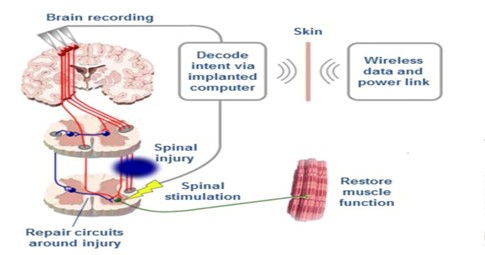 Patient rehabilitation progress